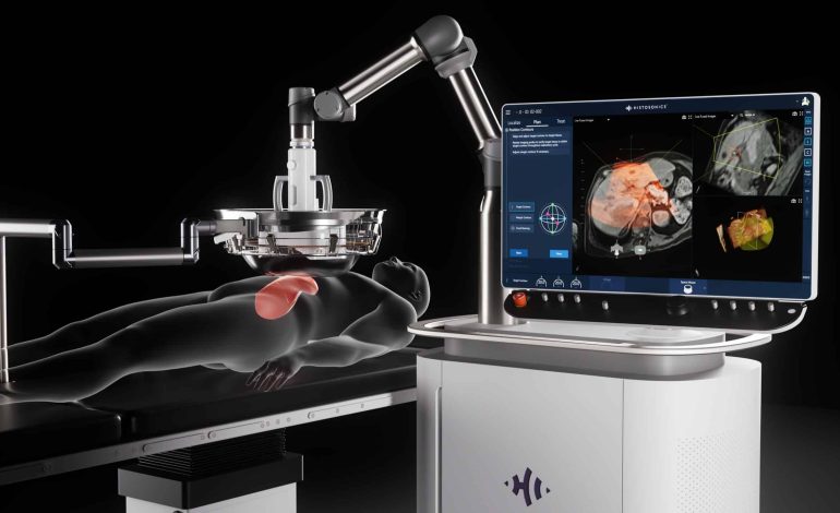 MEET EDISON: Non-Invasive Tumor Destruction